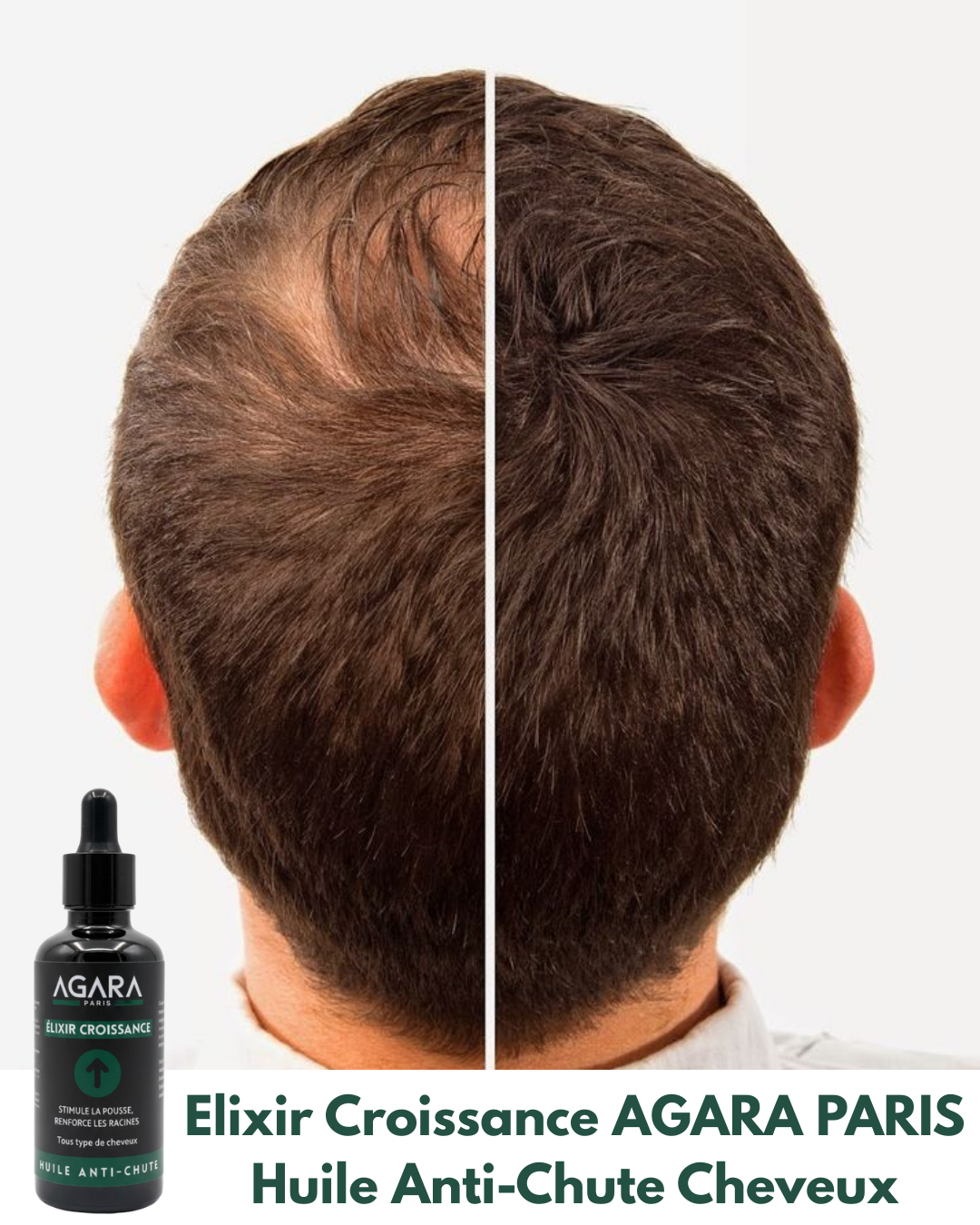 Elixir Croissance Agara - Huile Anti-Chute Cheveux - 50ml